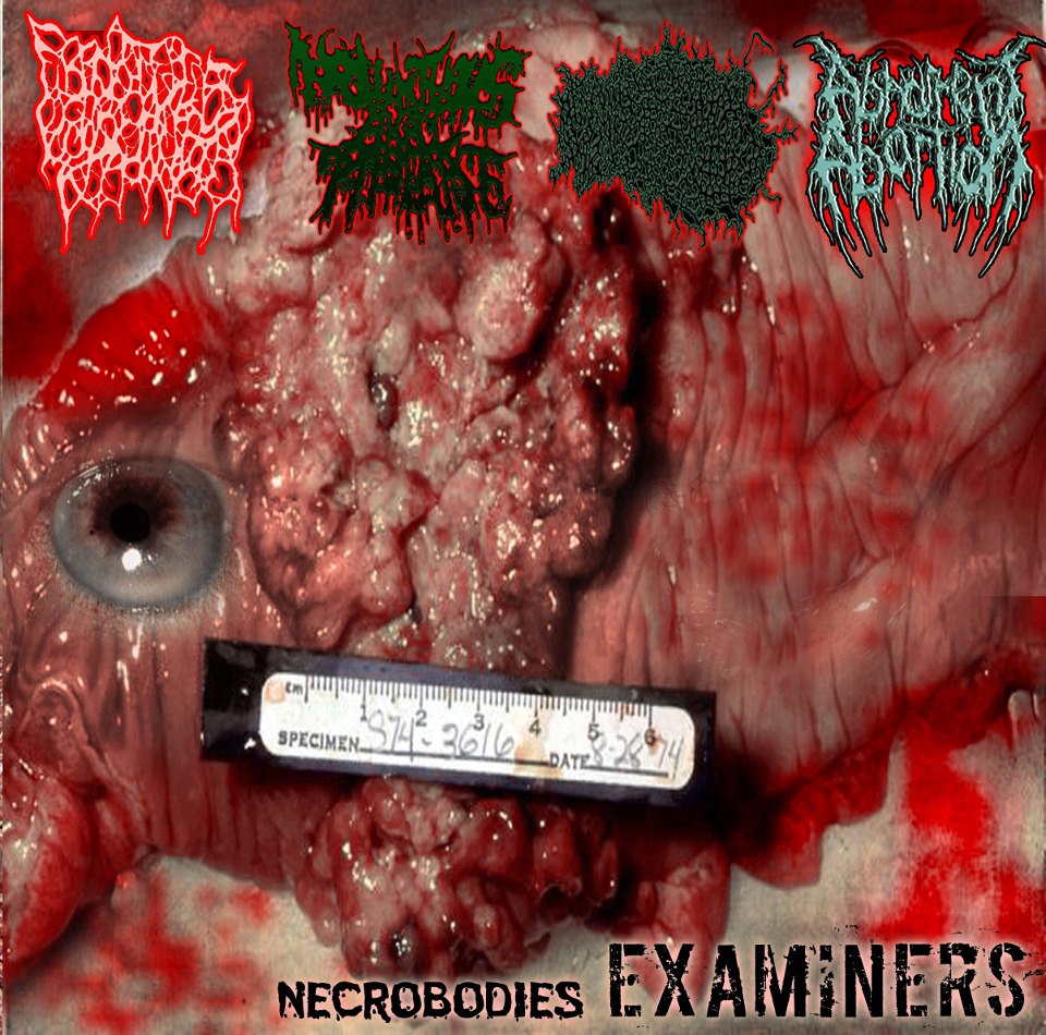 Prolapse Shit