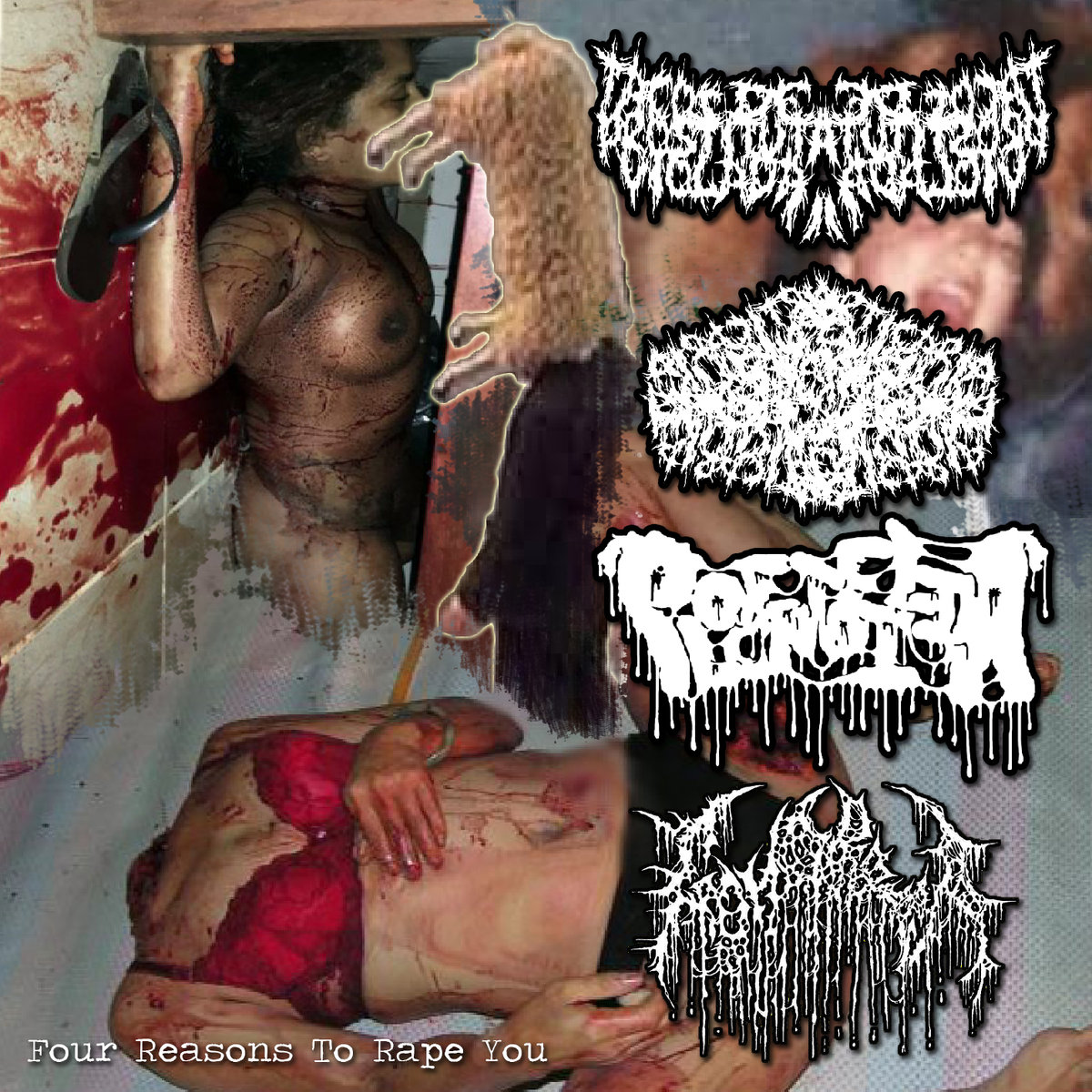 Metal Area - Extreme Music Portal > Gonorrea & Placentofilia & Urticaria  Penicilina Maligna & Txdxpxvx - Four Reasons To Rape You [split] (2018)